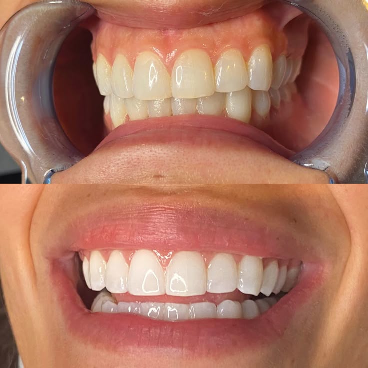 AVAPR_4.jpg__PID:2cb0ce76-69bc-49df-b04d-0860fd99eff0